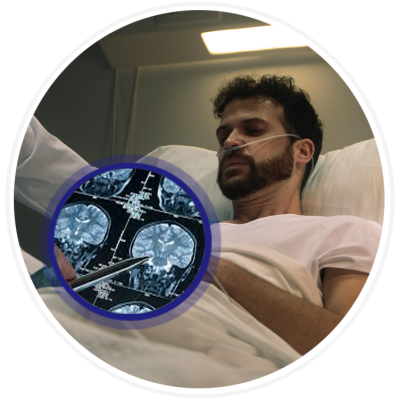 skull-based-malignancies